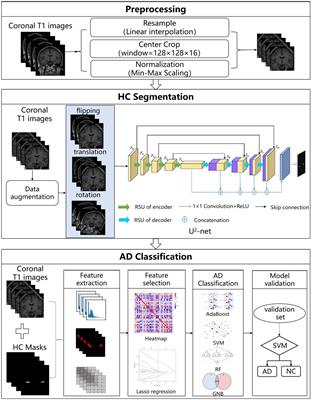 A novel cascade machine learning pipeline for Alzheimer’s disease identification and prediction